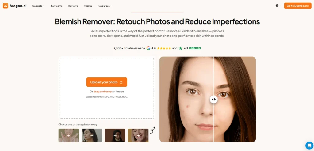 Aragon - Blemish Remover